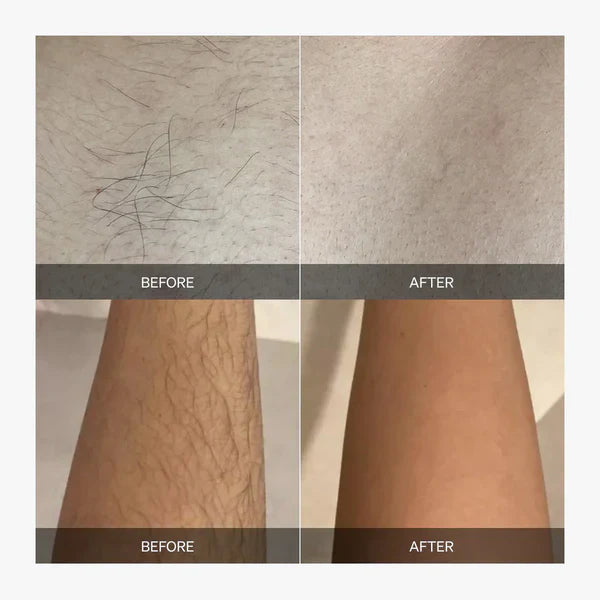 powerstep® Painless Laser Hair Remover