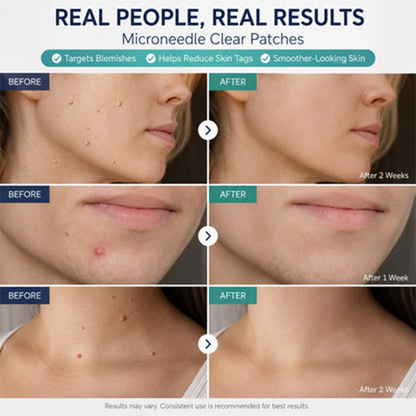 🩹 Target Unwanted Skin Tags With One Simple Patch ✨
