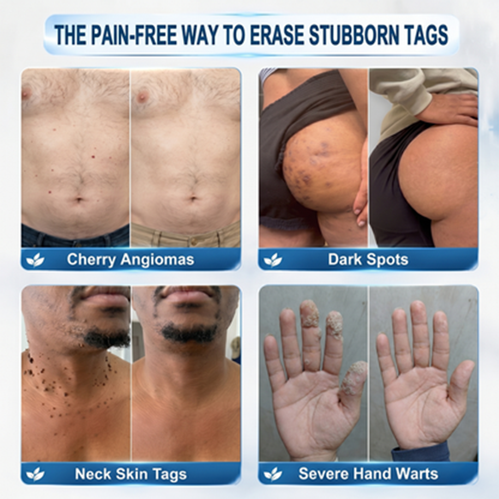 🩹 Target Unwanted Skin Tags With One Simple Patch ✨