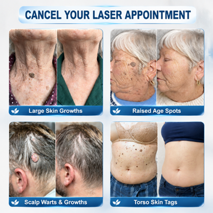 🩹 Target Unwanted Skin Tags With One Simple Patch ✨