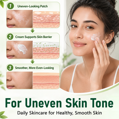 Rolimey® Herbal Vitiligo Cream