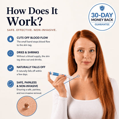 🗽GFOUK®Skintag Removal Kit