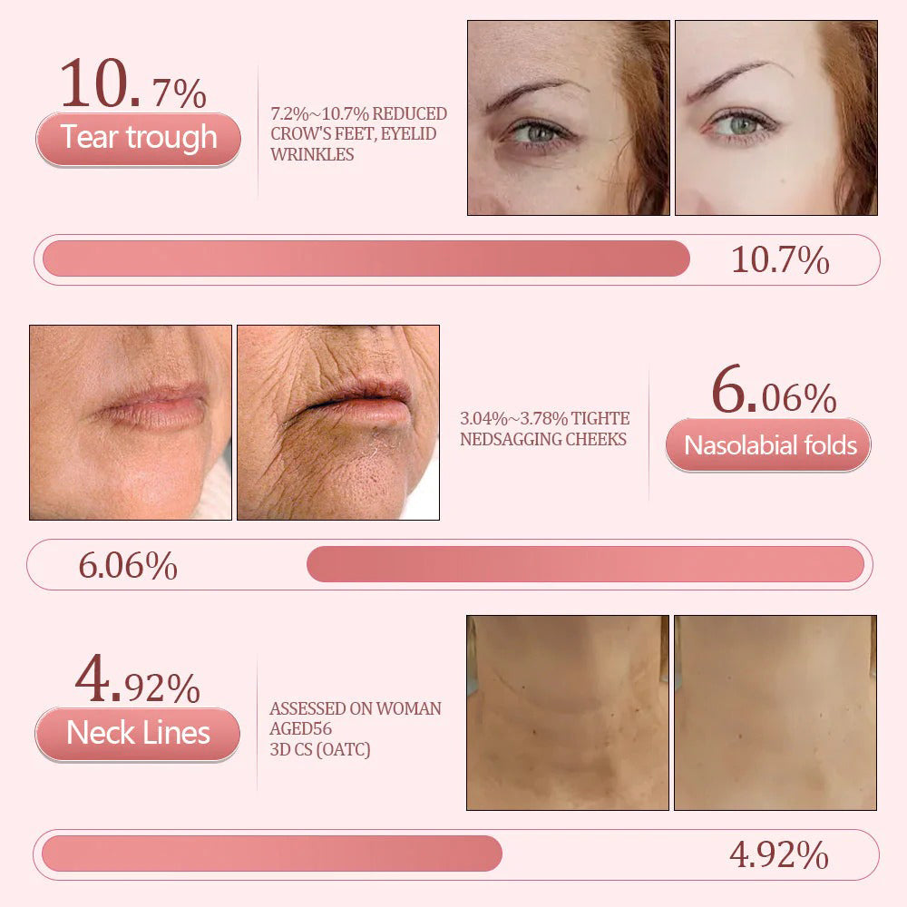 flysmus® PDRN Pink Collagen Volume Multi Repair Balm