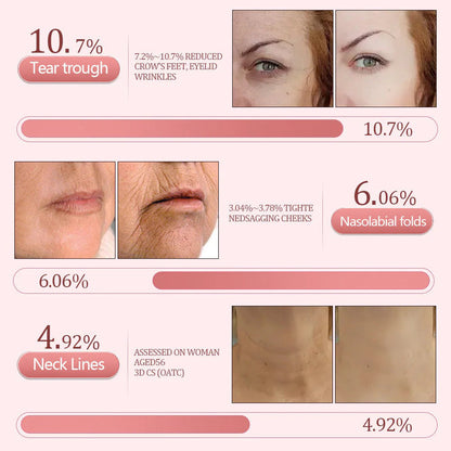 flysmus® PDRN Pink Collagen Volume Multi Repair Balm
