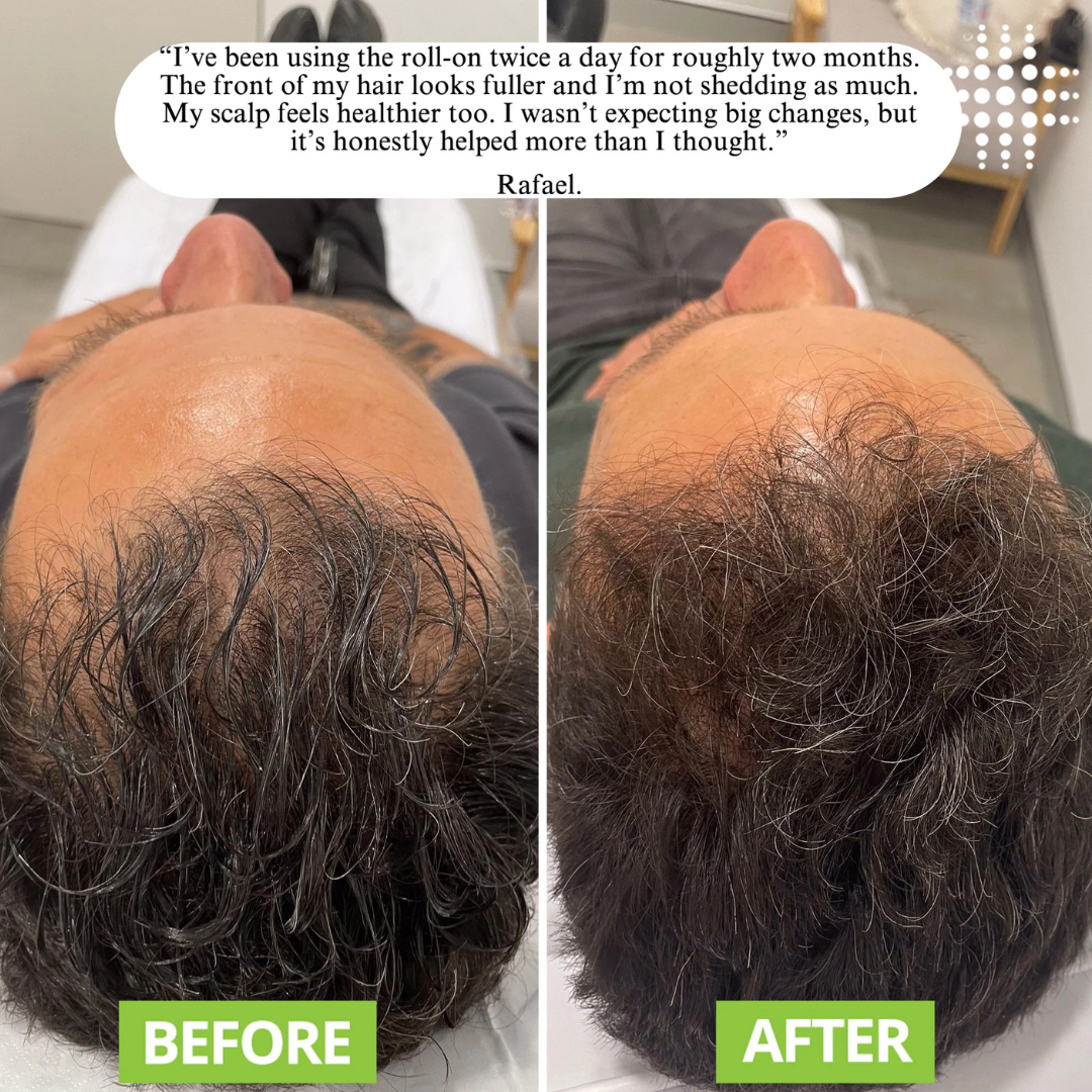 Evolvion® Hair & Scalp Care Serum for Fuller-Looking Hair