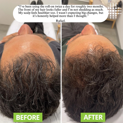Evolvion® Hair & Scalp Care Serum for Fuller-Looking Hair