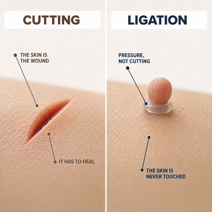🗽GFOUK®Skintag Removal Kit