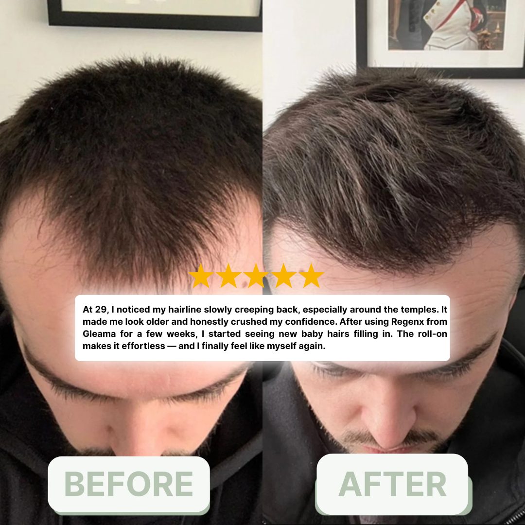 Evolvion® Hair & Scalp Care Serum for Fuller-Looking Hair