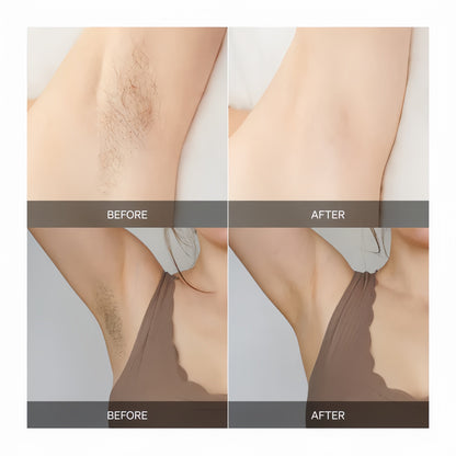 powerstep® Painless Laser Hair Remover