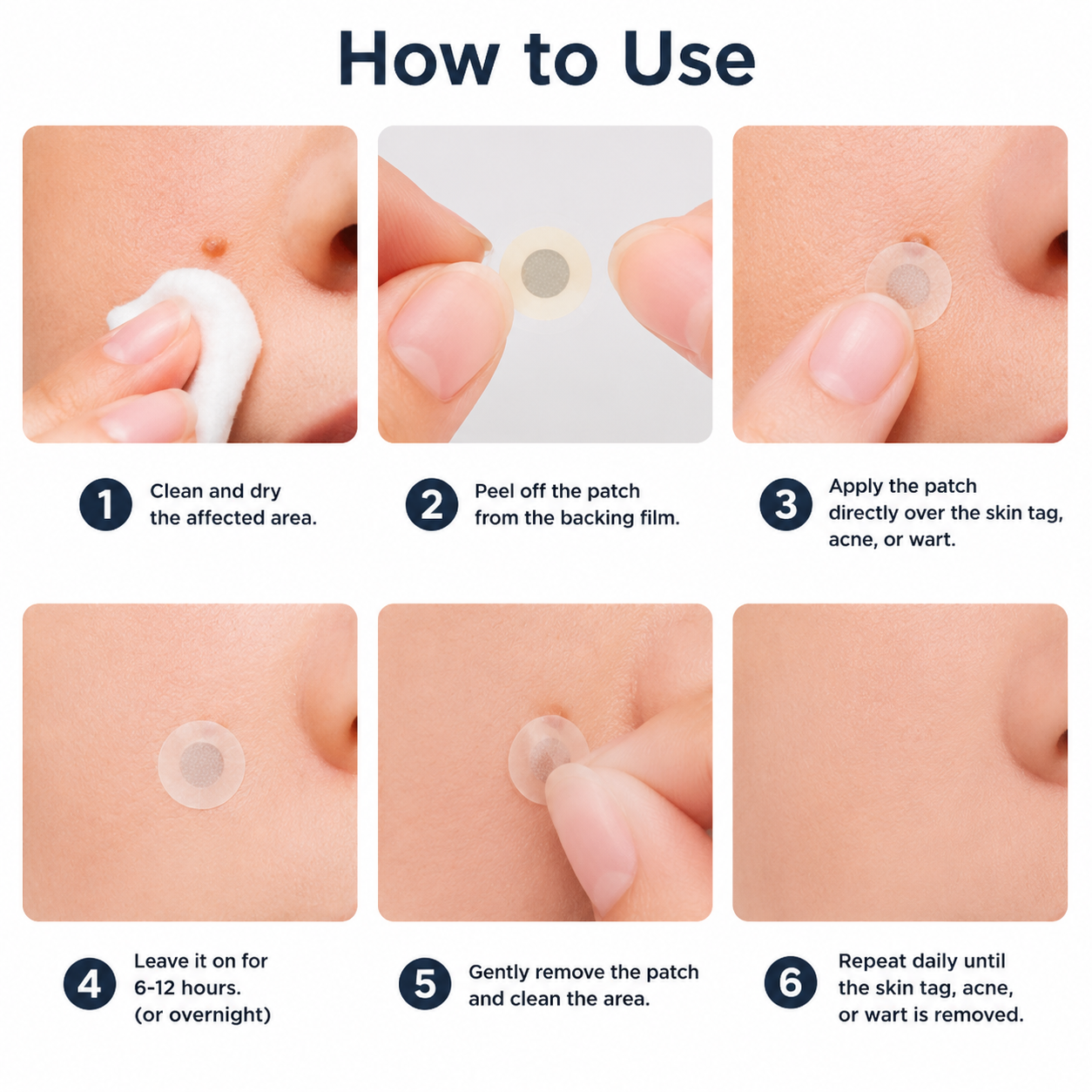 🗽GFOUK® 2-in-1 Microneedle & Hydrocolloid Skin Care Patches
