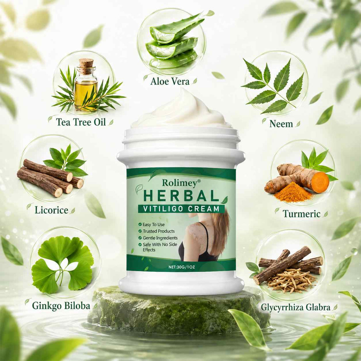 Rolimey® Herbal Vitiligo Cream