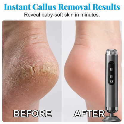 🏖️Summer Cool Deal: 49% OFF!!👍🎉5-Speed Electric Foot Renewal System