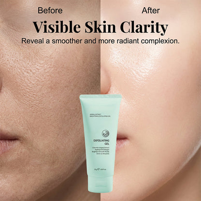 ✨ Smooth Rough, Dull Skin in Minutes 💧🌟